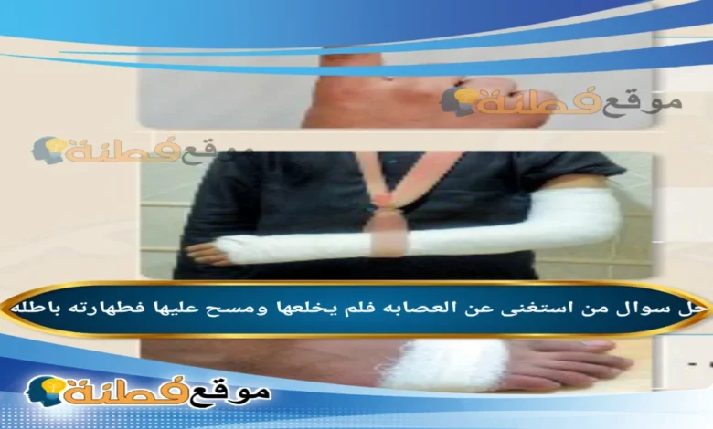 من استغنى عن العصابه فلم يخلعها ومسح عليها فطهارته باطله