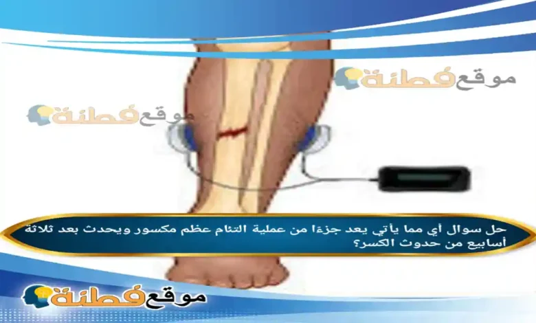 أي مما يأتي يعد جزءًا من عملية التئام عظم مكسور ويحدث بعد ثلاثة أسابيع من حدوث الكسر