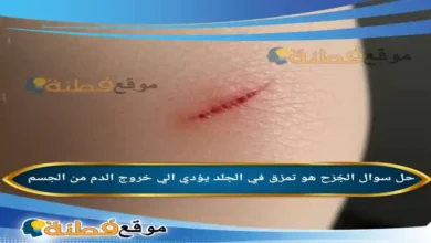 الجُرْح هو تمزق في الجلد يؤدي الي خروج الدم من الجسم