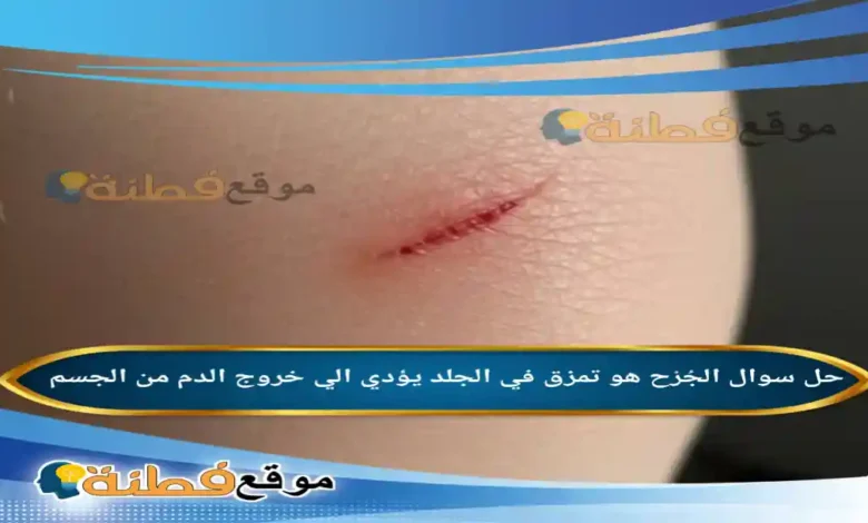 الجُرْح هو تمزق في الجلد يؤدي الي خروج الدم من الجسم