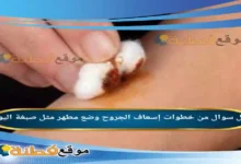 من خطوات إسعاف الجروح وضع مطهر مثل صبغة اليود