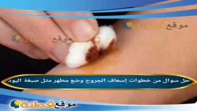 من خطوات إسعاف الجروح وضع مطهر مثل صبغة اليود