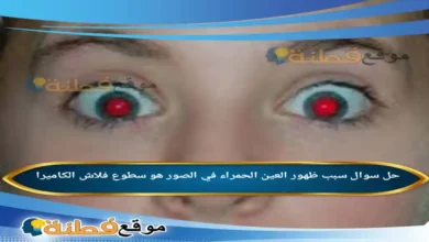 سبب ظهور العين الحمراء في الصور هو سطوع فلاش الكاميرا